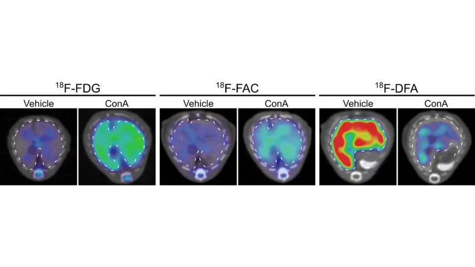 PET images of a mouse liver in normal mice and a mouse model of autoimmune hepatitis
